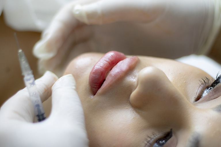 A woman getting lip fillers from a certified practitioner