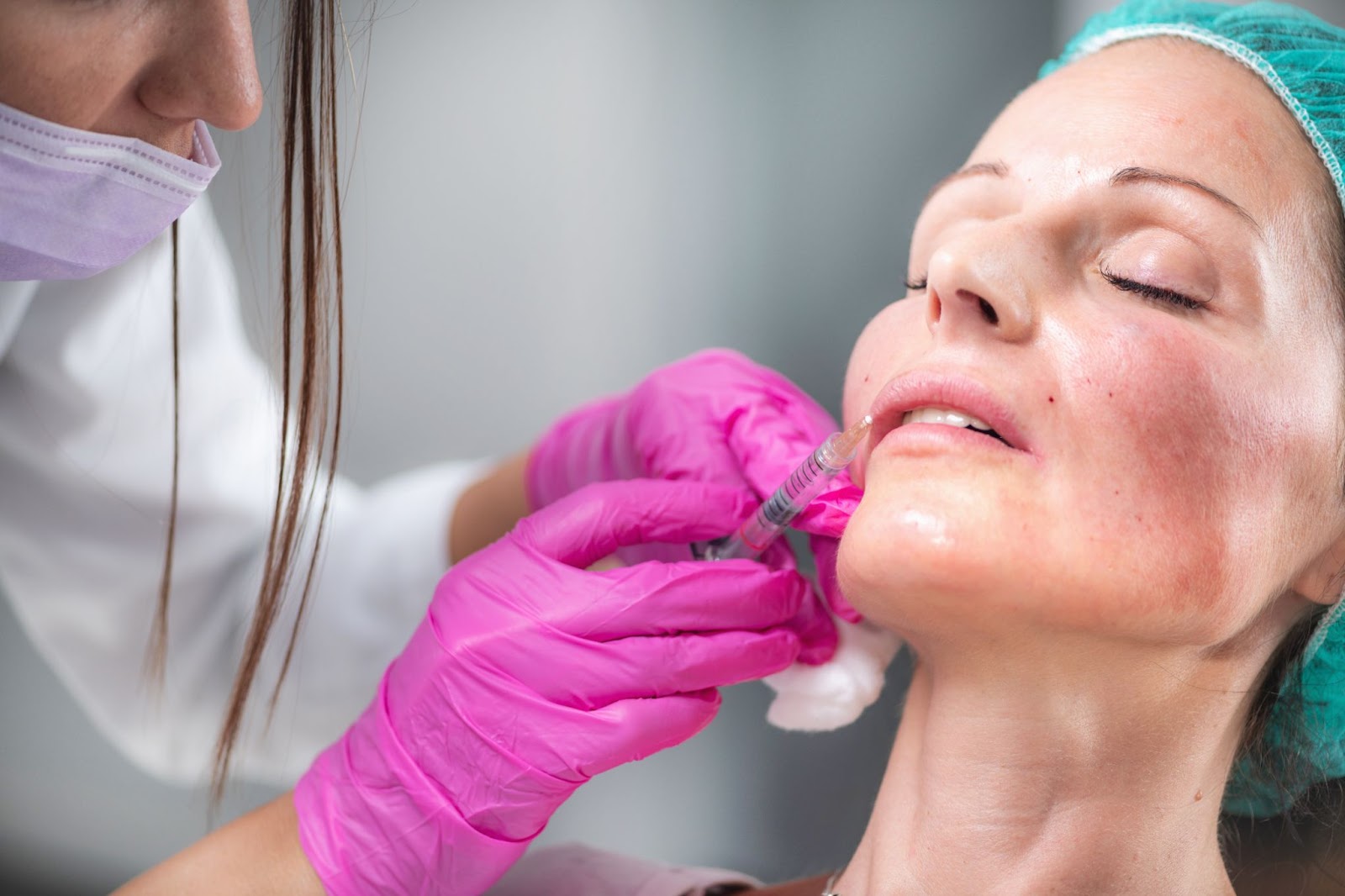 An aesthetician injects a patient with lip filler