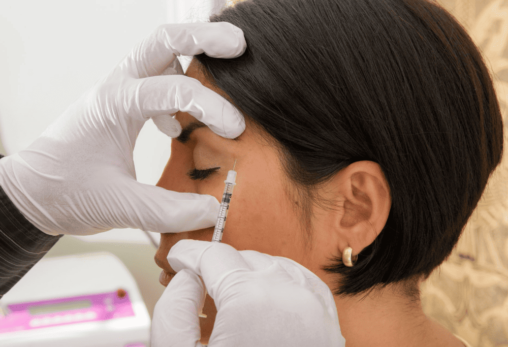 A woman getting Botox injections for migraines on her temple