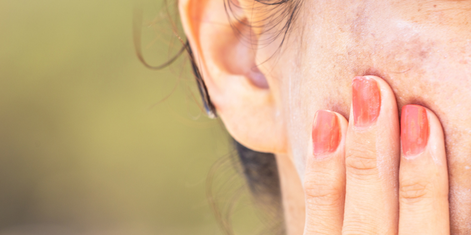 Hyperpigmentation treatment recurrence prevention