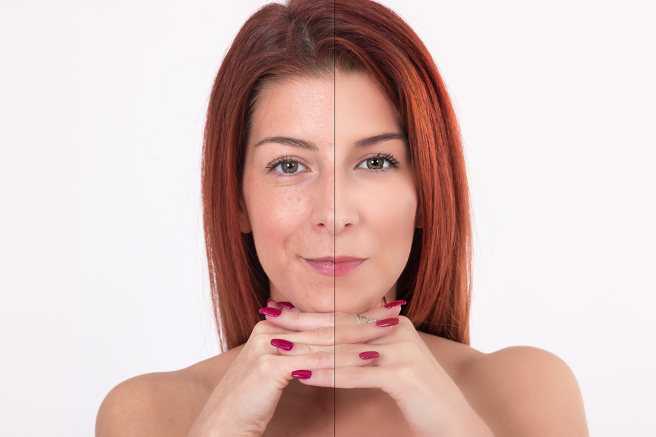 Patient consultation discussing personalized collagen treatment plan